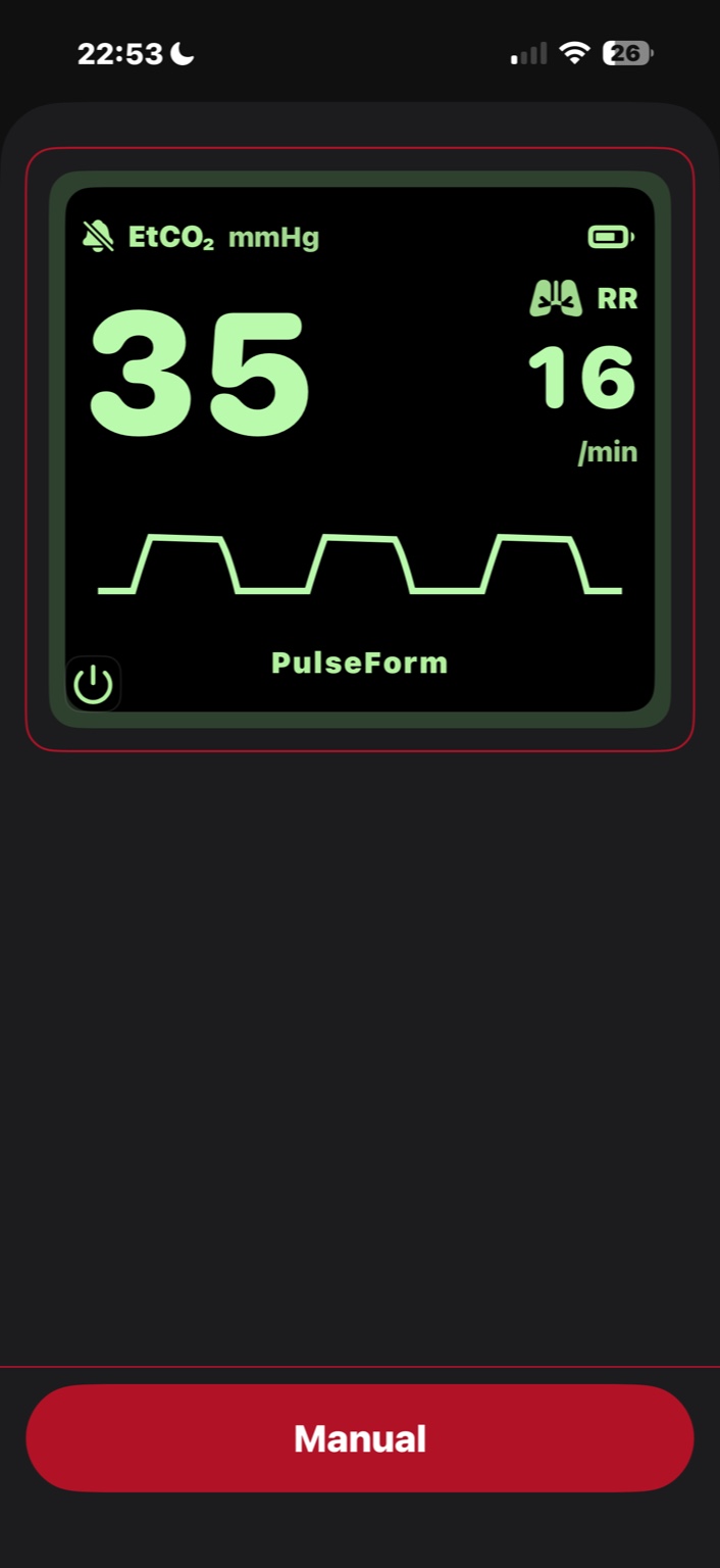 PulseForm capnography monitor screen